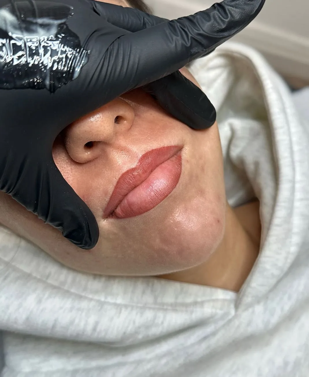 24 Hours Without Ointment