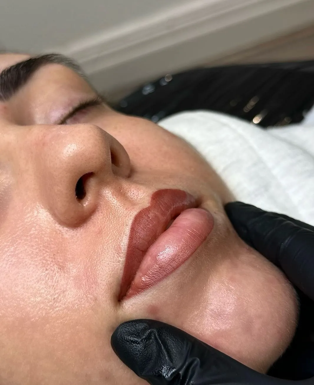 Safe Substitutes When You Don’t Have Ointment