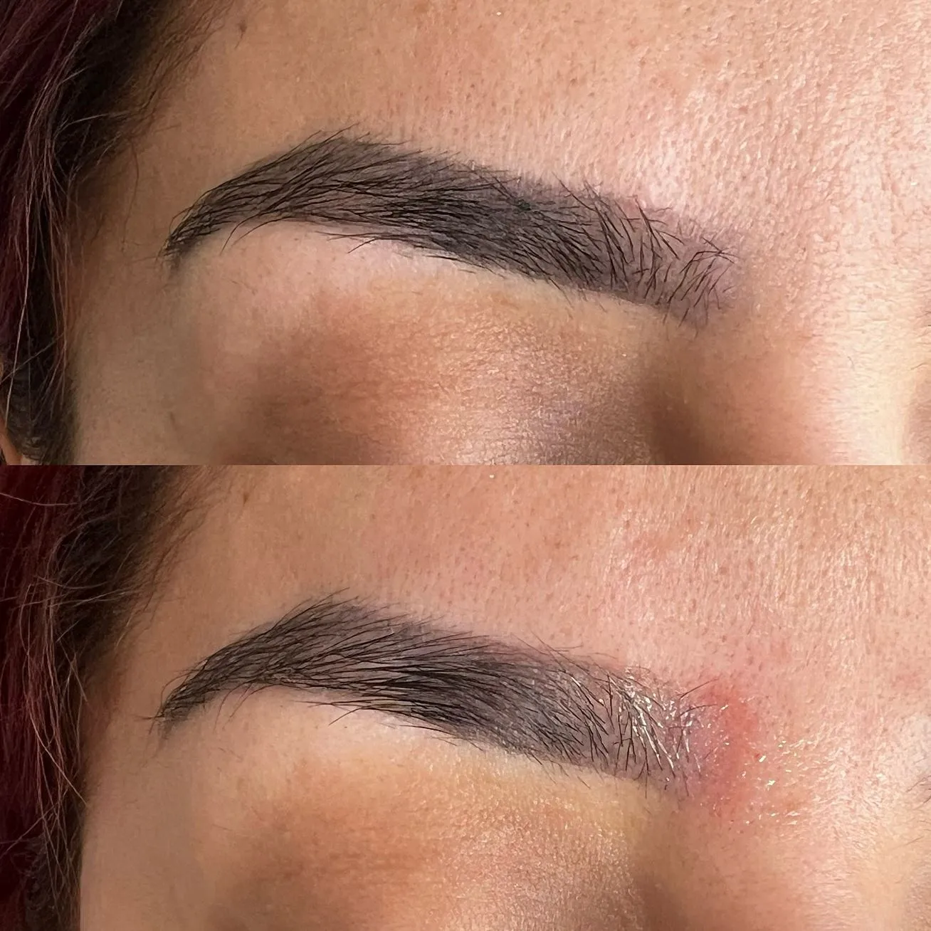 The Truth About Scarring, Risks vs Reality