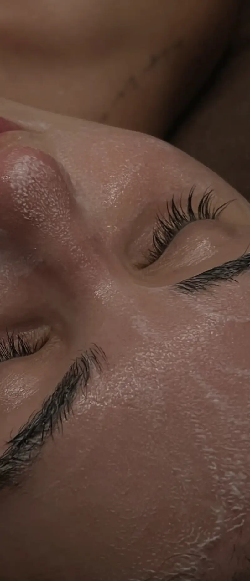 dermaplaning course dublin